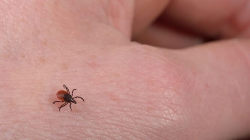 Tick season has arrived Here's how to protect yourself from Lyme